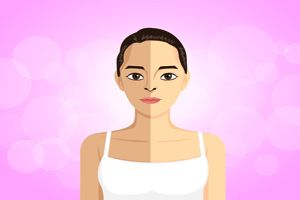 如何才能淡化妊娠纹