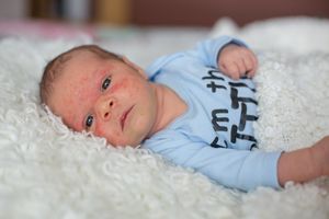新生婴儿肚子硬怎么回事
