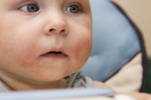 9个月婴幼儿腹泻怎么办