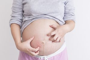 怀孕鼻塞胎儿会缺氧吗