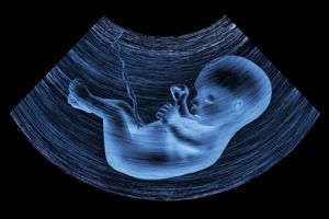 孕妇空腹血糖5.6是高危产妇吗