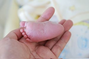 剖腹产入院需要准备什么